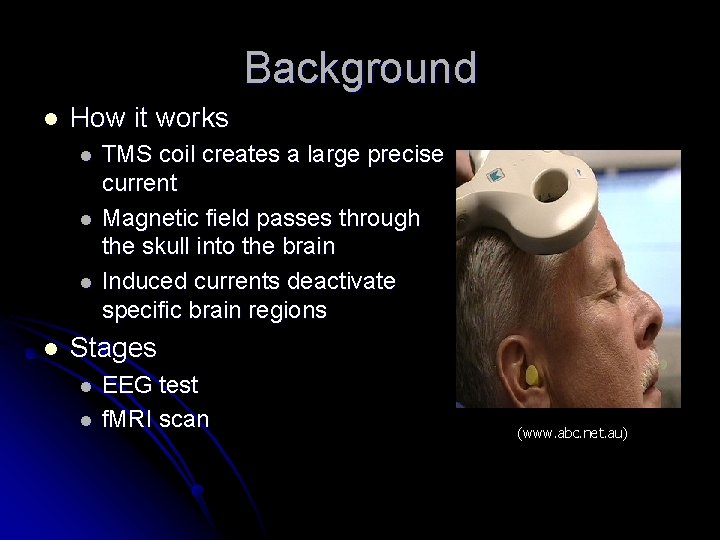 Tms Explained Transcranial Magnetic Stimulation Positioner Team Jonathan Baran Chris