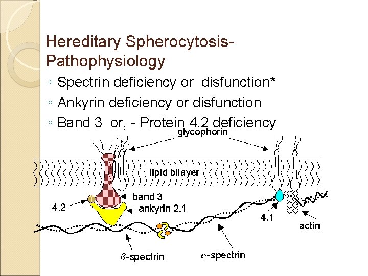 Hereditary Spherocytosis. Pathophysiology ◦ Spectrin deficiency or disfunction* ◦ Ankyrin deficiency or disfunction ◦