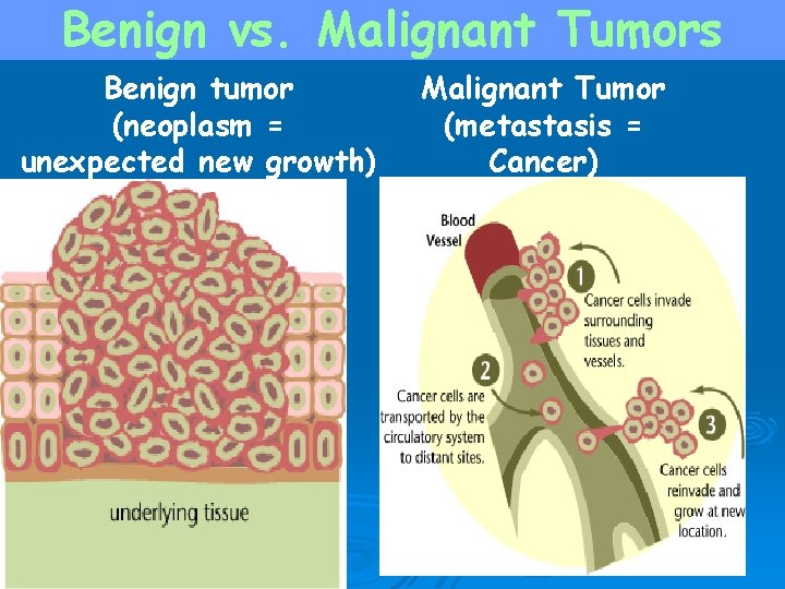 Benign vs. Malignant Tumors Benign tumor (neoplasm = unexpected new growth) Malignant Tumor (metastasis