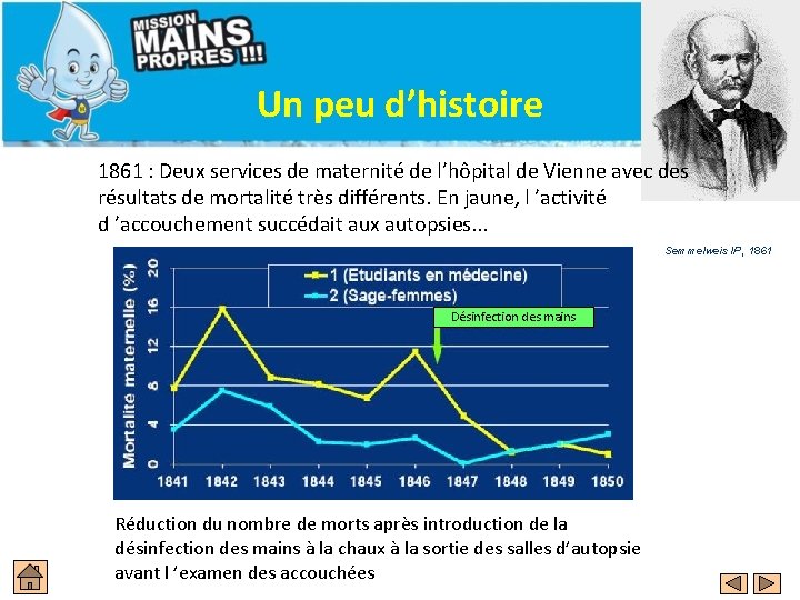 Un peu d’histoire 1861 : Deux services de maternité de l’hôpital de Vienne avec