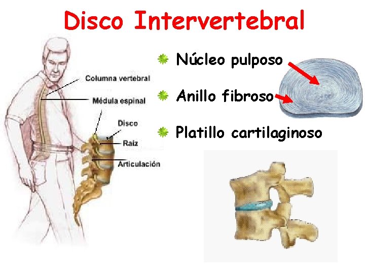 Disco Intervertebral Núcleo pulposo Anillo fibroso Platillo cartilaginoso 