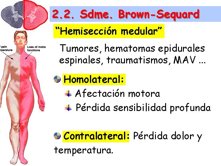 2. 2. Sdme. Brown-Sequard “Hemisección medular” Tumores, hematomas epidurales espinales, traumatismos, MAV. . .