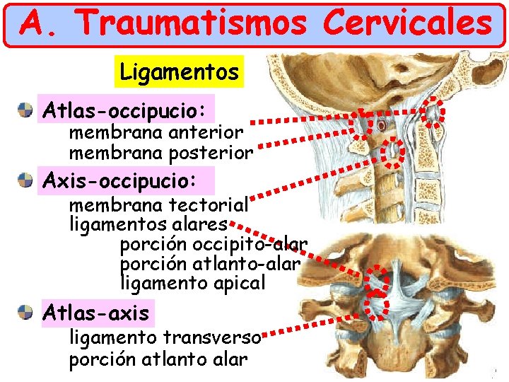 A. Traumatismos Cervicales Ligamentos Atlas-occipucio: membrana anterior membrana posterior Axis-occipucio: membrana tectorial ligamentos alares