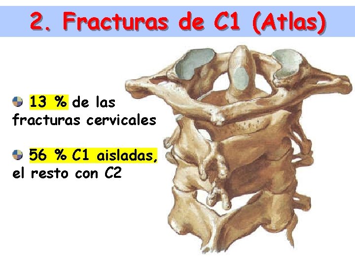 2. Fracturas de C 1 (Atlas) 13 % de las fracturas cervicales 56 %