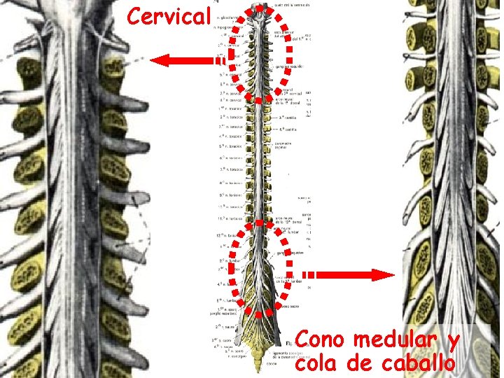 Cervical Cono medular y cola de caballo 