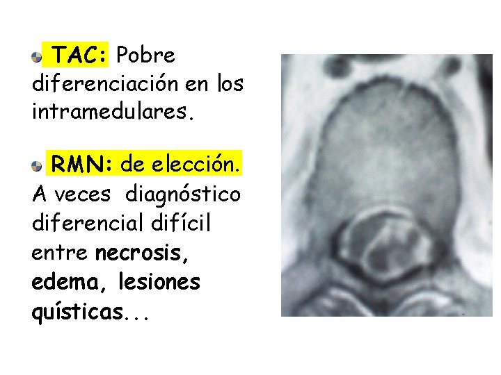 TAC: Pobre diferenciación en los intramedulares. RMN: de elección. A veces diagnóstico diferencial difícil
