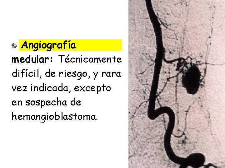 Angiografía medular: Técnicamente difícil, de riesgo, y rara vez indicada, excepto en sospecha de