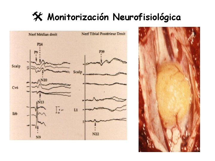 @ Monitorización Neurofisiológica 