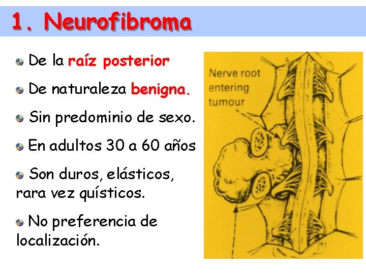 1. Neurofibroma De la raíz posterior De naturaleza benigna. Sin predominio de sexo. En
