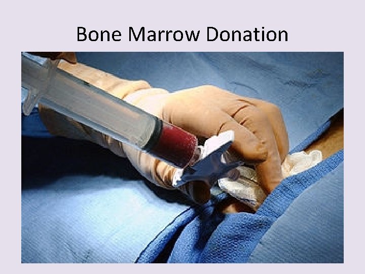 Bone Marrow Donation 