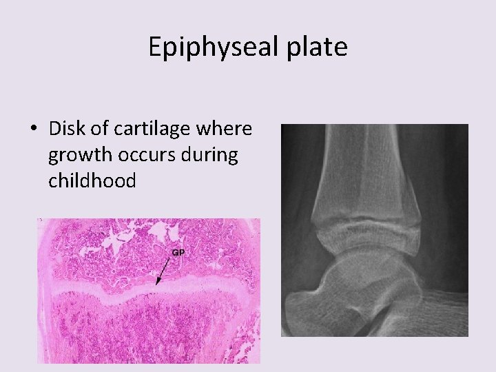 Epiphyseal plate • Disk of cartilage where growth occurs during childhood 