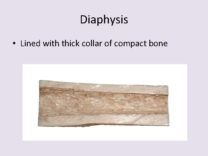 Diaphysis • Lined with thick collar of compact bone 