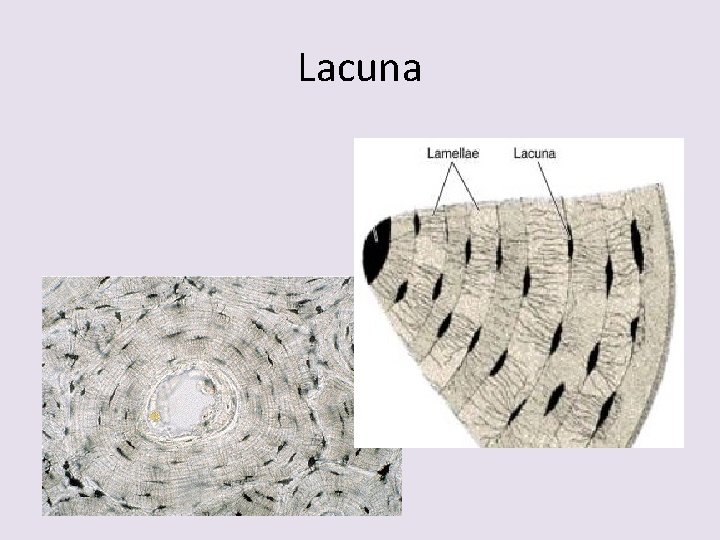 Lacuna 