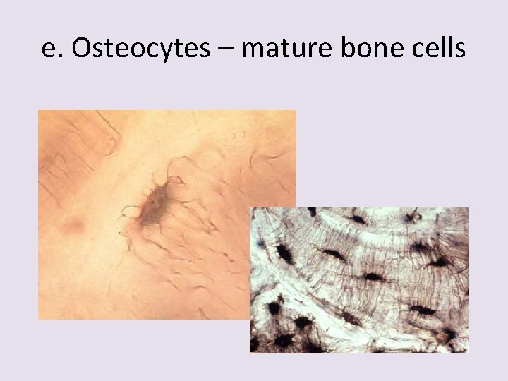 e. Osteocytes – mature bone cells 