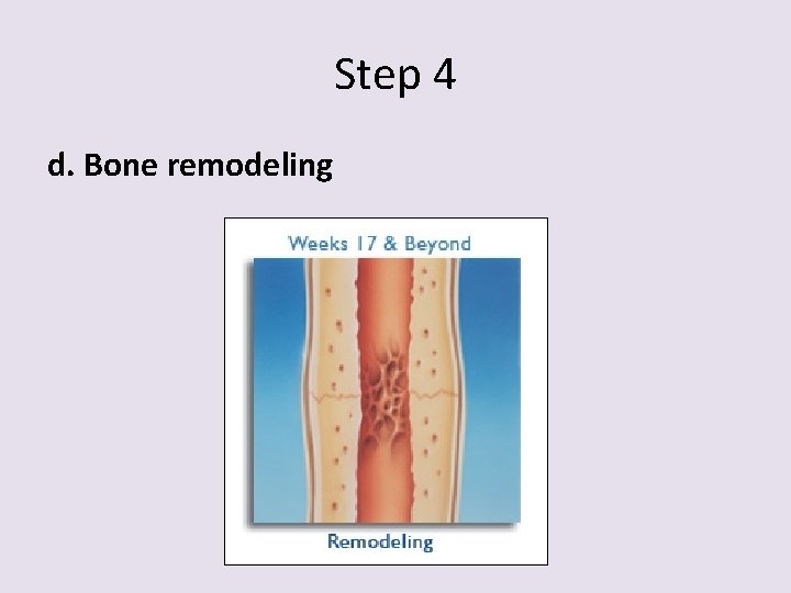 Step 4 d. Bone remodeling 