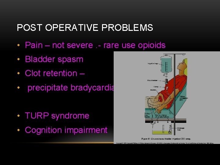 POST OPERATIVE PROBLEMS • Pain – not severe. - rare use opioids • Bladder