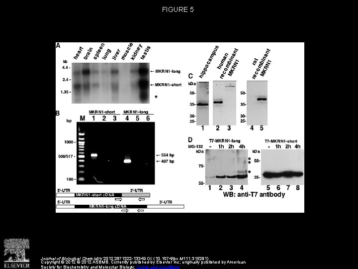 Makorin Ring Zinc Finger Protein 1 MKRN 1