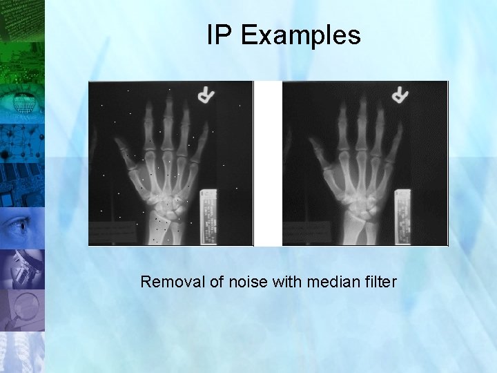 IP Examples Removal of noise with median filter 17 