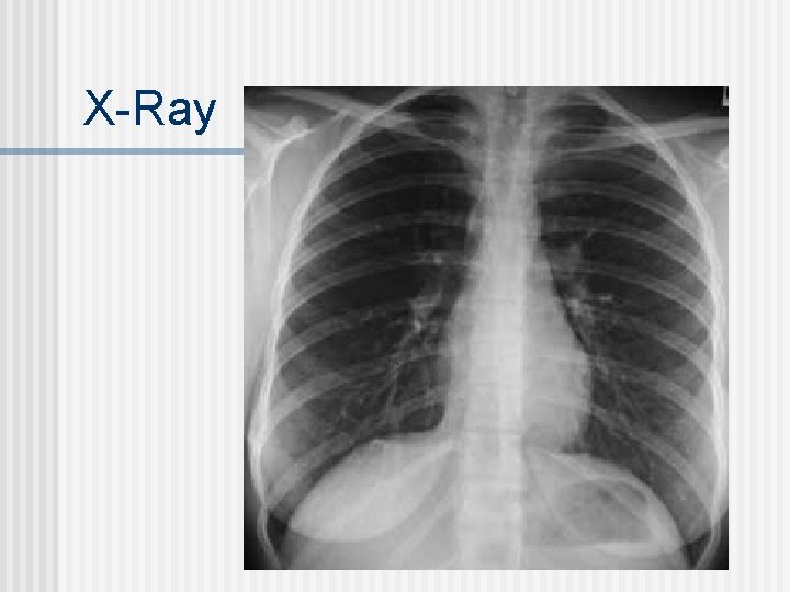 X-Ray 