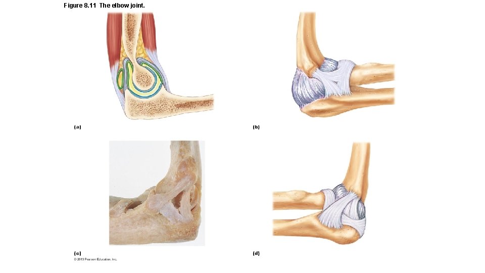 Figure 8. 11 The elbow joint. 