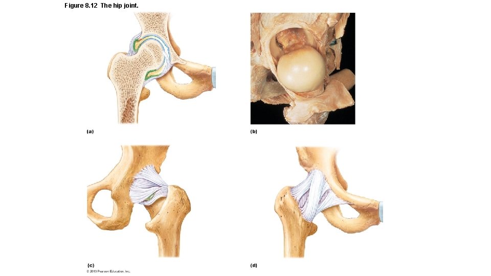 Figure 8. 12 The hip joint. 