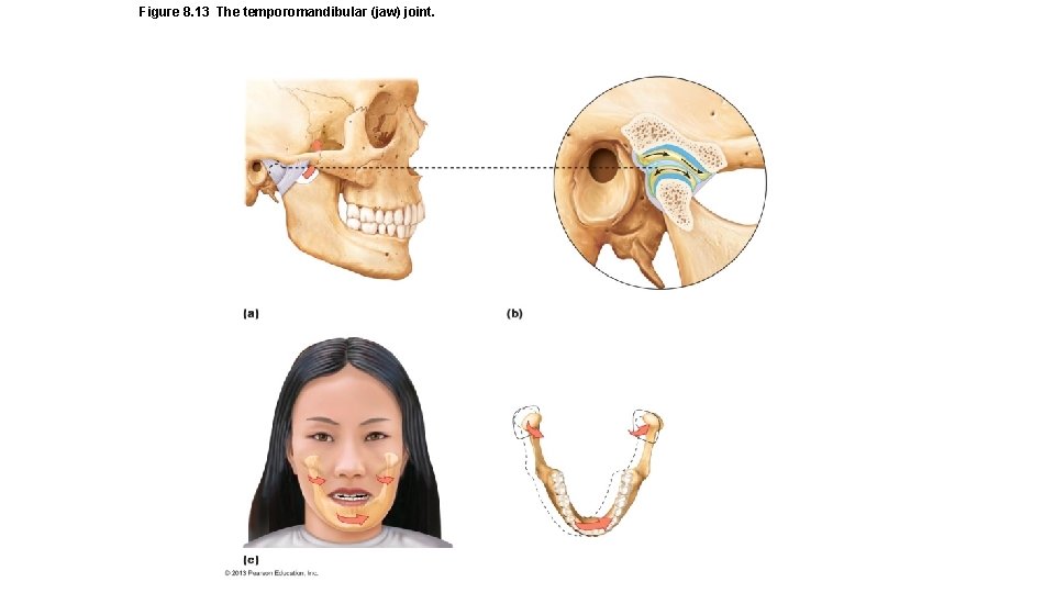 Figure 8. 13 The temporomandibular (jaw) joint. 