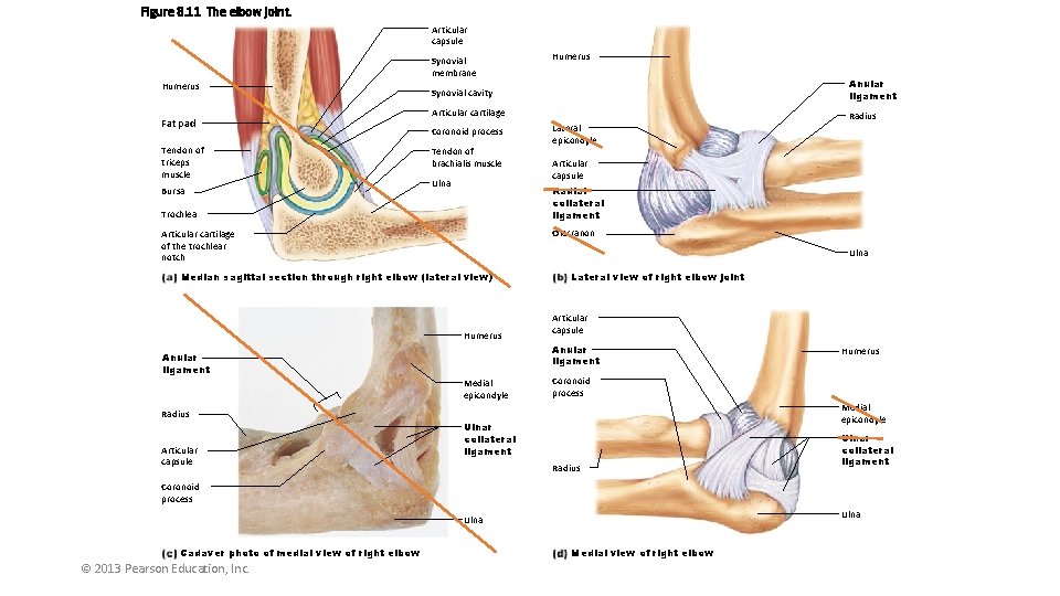 Figure 8. 11 The elbow joint. Articular capsule Synovial membrane Humerus Fat pad Tendon