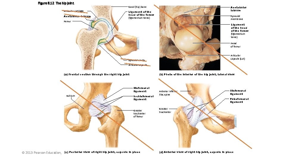 Figure 8. 12 The hip joint. Articular cartilage Acetabular labrum Coxal (hip) bone Acetabular