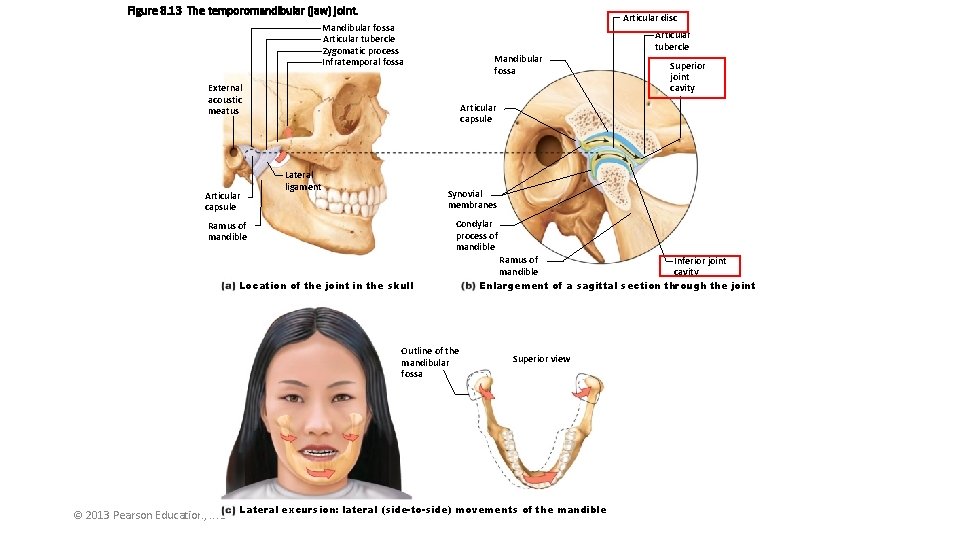 Figure 8. 13 The temporomandibular (jaw) joint. Articular disc Mandibular fossa Articular tubercle Zygomatic