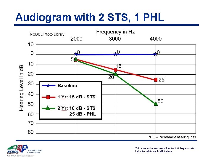 Audiogram with 2 STS, 1 PHL – Permanent hearing loss This presentation was created Audiogram with 2 STS, 1 PHL – Permanent hearing loss This presentation was created