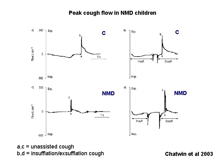 Peak cough flow in NMD children C C NMD a, c = unassisted cough