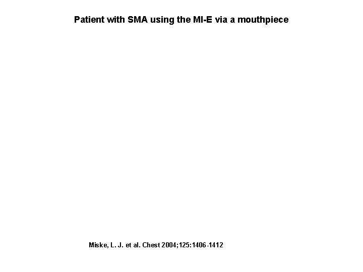 Patient with SMA using the MI-E via a mouthpiece Miske, L. J. et al.