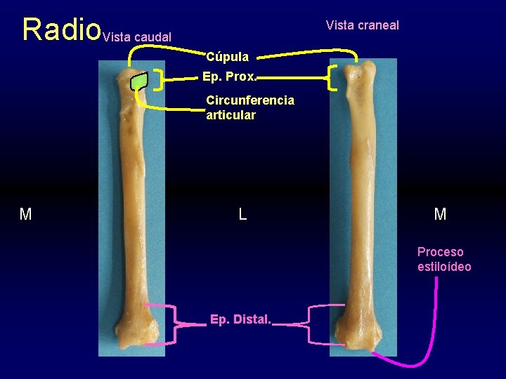 Radio. Vista caudal Vista craneal Cúpula Ep. Prox. Circunferencia articular M L M Proceso