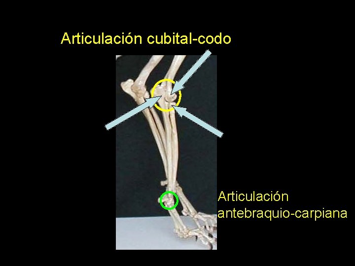 Articulación cubital-codo Articulación antebraquio-carpiana 