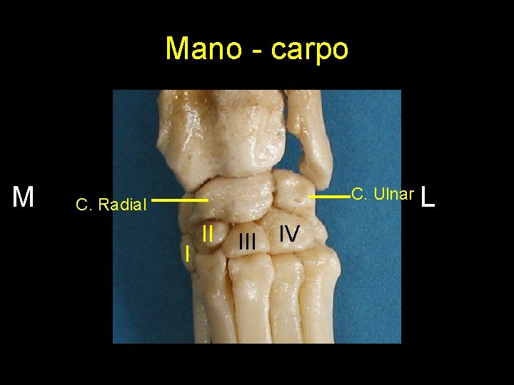 Mano - carpo M C. Ulnar C. Radial I II IV L 