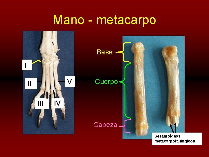 Mano - metacarpo Base I V II III Cuerpo IV Cabeza Sesamoídeos metacarpofalángicos 