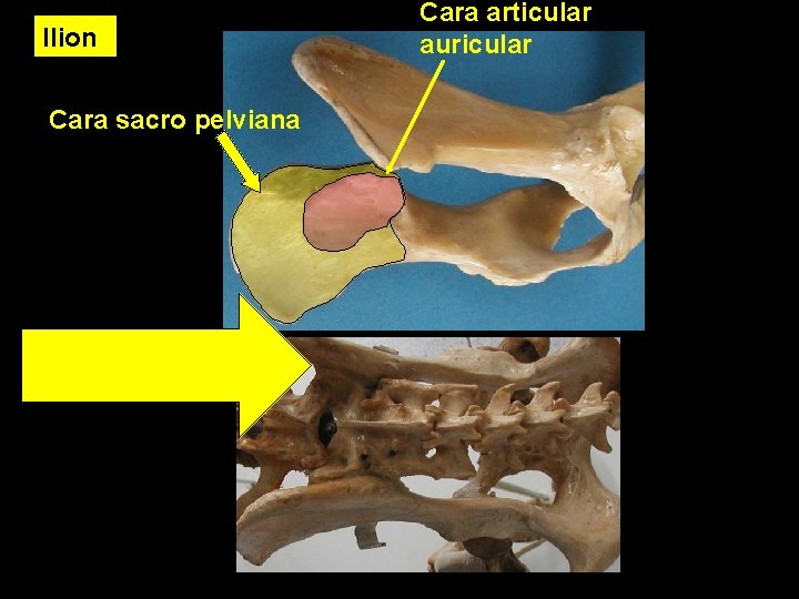 Ilion Cara sacro pelviana Cara articular auricular 