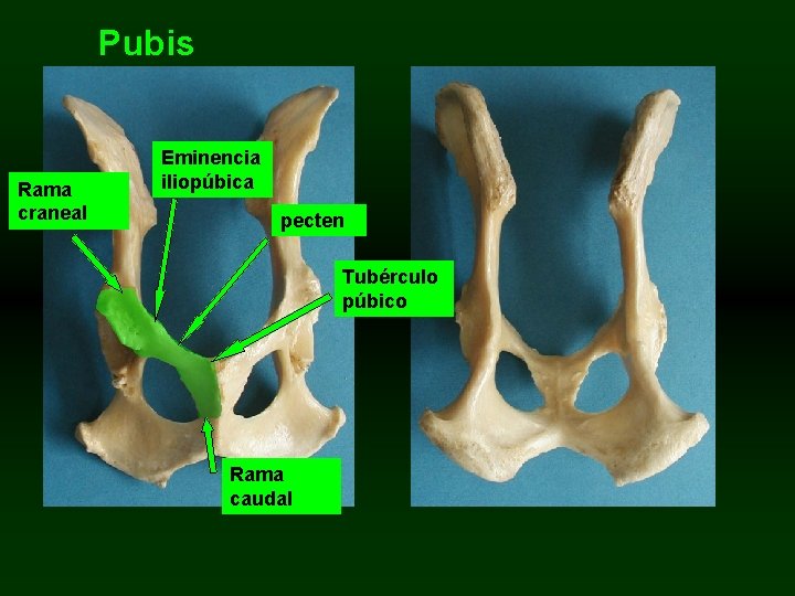 Pubis Rama craneal Eminencia iliopúbica pecten Tubérculo púbico Rama caudal 