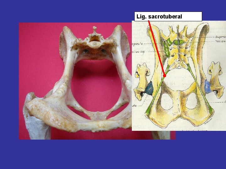 Lig. sacrotuberal 