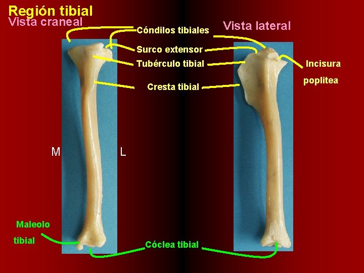 Región tibial Vista craneal Cóndilos tibiales Vista lateral Surco extensor Tubérculo tibial Cresta tibial