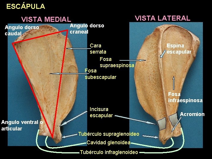 ESCÁPULA VISTA LATERAL VISTA MEDIAL Angulo dorso caudal Angulo dorso craneal Cara serrata Fosa