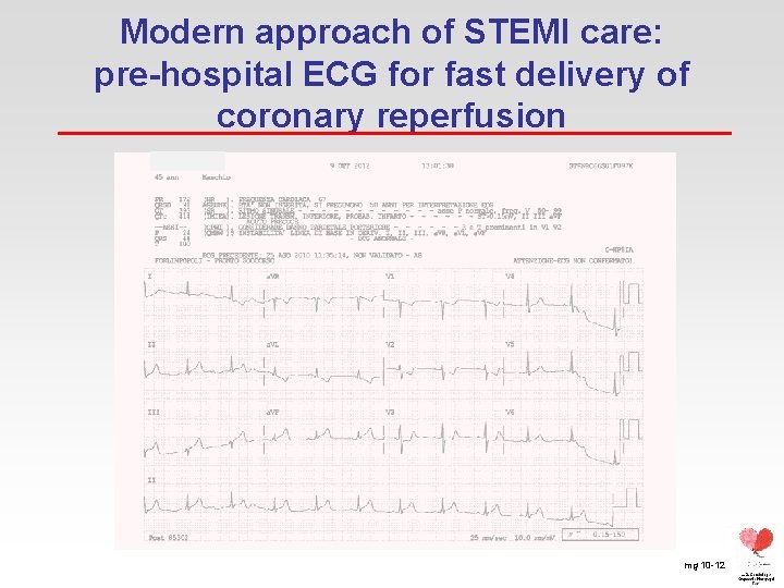 Modern approach of STEMI care: pre-hospital ECG for fast delivery of coronary reperfusion mg