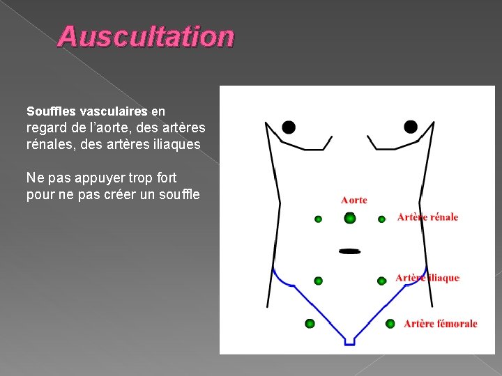 Auscultation Souffles vasculaires en regard de l’aorte, des artères rénales, des artères iliaques Ne