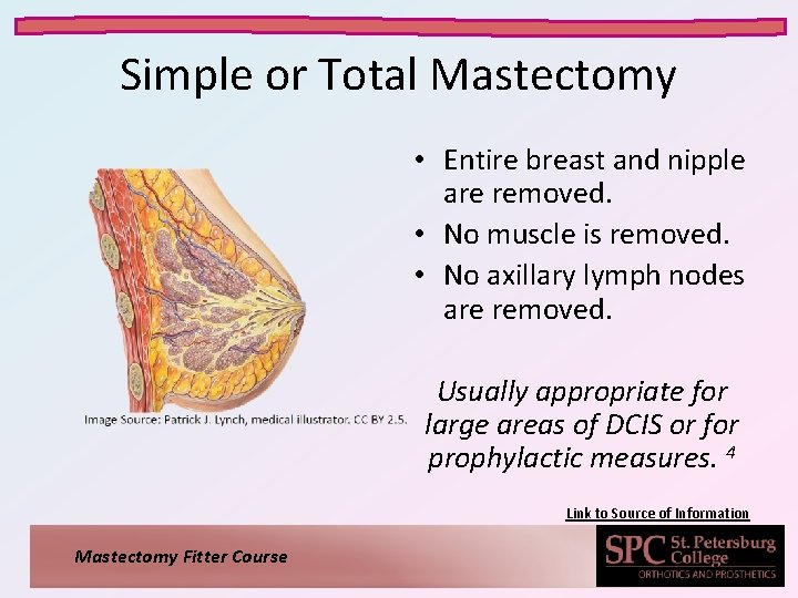 Simple or Total Mastectomy • Entire breast and nipple are removed. • No muscle