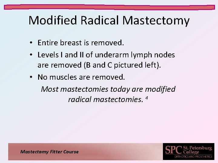 Modified Radical Mastectomy • Entire breast is removed. • Levels I and II of