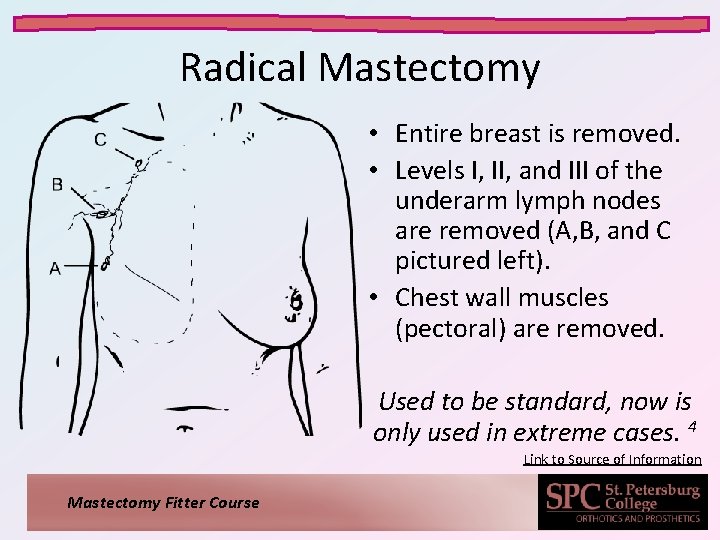 Radical Mastectomy • Entire breast is removed. • Levels I, II, and III of