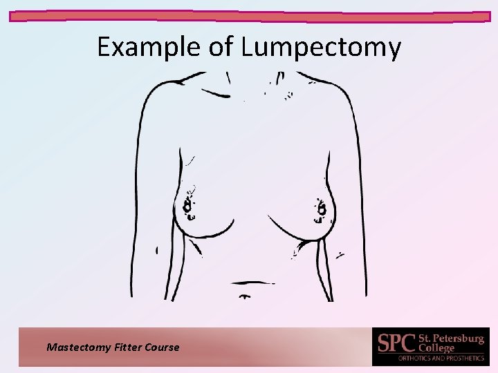 Example of Lumpectomy Mastectomy Fitter Course 