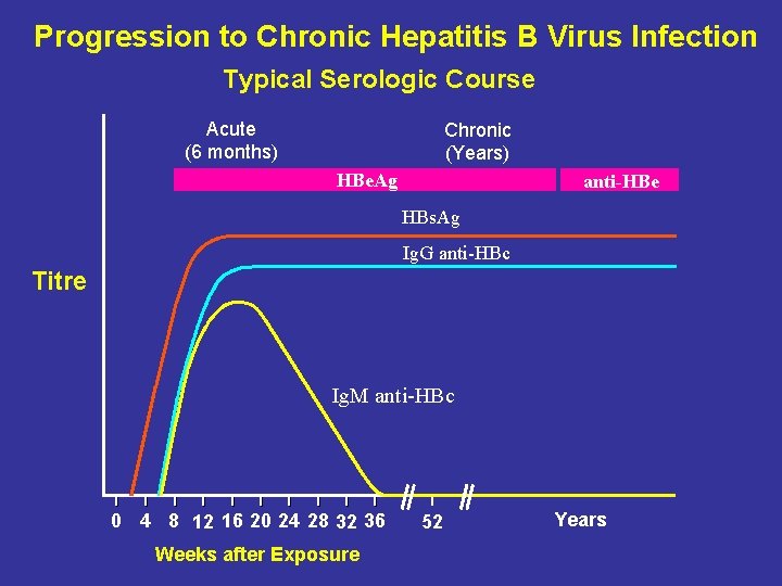 Progression to Chronic Hepatitis B Virus Infection Typical Serologic Course Acute (6 months) Chronic