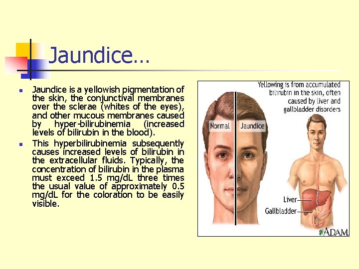 Jaundice… n n Jaundice is a yellowish pigmentation of the skin, the conjunctival membranes