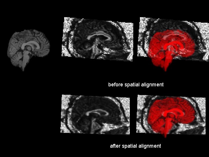 before spatial alignment after spatial alignment 